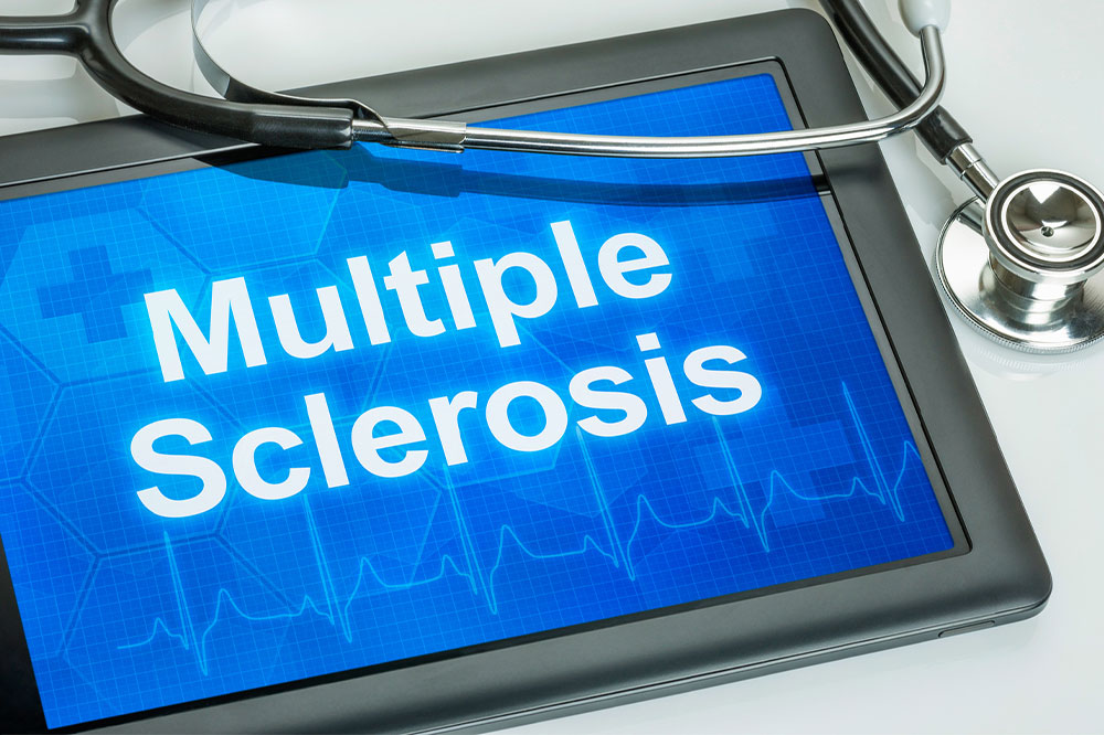 10 Vital Multiple Sclerosis Facts